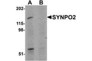 Image no. 1 for anti-Synaptopodin 2 (SYNPO2) (N-Term) antibody (ABIN783775)