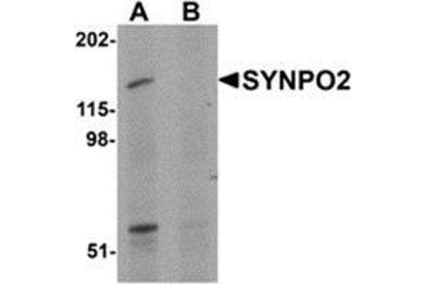 SYNPO2 抗体  (N-Term)