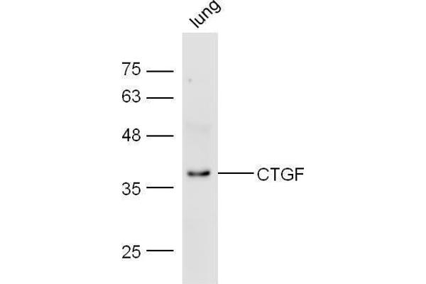 CTGF 抗体  (AA 221-349)