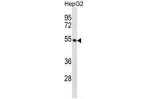 Image no. 1 for anti-Keratin 26 (KRT26) (AA 116-146), (N-Term) antibody (ABIN951814)