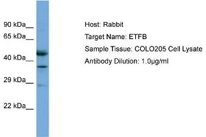 Image no. 1 for anti-Electron-Transfer-Flavoprotein, beta Polypeptide (ETFB) (C-Term) antibody (ABIN2785713)