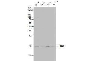 Image no. 6 for anti-Fission 1 (FIS1) (full length) antibody (ABIN2856782)