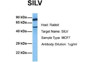 Image no. 1 for anti-Premelanosome Protein (PMEL) (N-Term) antibody (ABIN2782746)