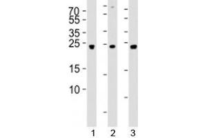 Image no. 2 for anti-Ubiquitin Carboxyl-terminal Esterase L3 (Ubiquitin Thiolesterase) (Uchl3) (AA 195-225) antibody (ABIN3029426)