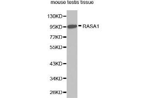 Image no. 1 for anti-RAS P21 Protein Activator (GTPase Activating Protein) 1 (RASA1) antibody (ABIN3022297)