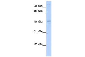 Image no. 1 for anti-FYVE, RhoGEF and PH Domain Containing 1 (FGD1) (N-Term) antibody (ABIN2780596)