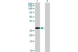 Image no. 1 for anti-Complement Factor H-Related 2 (CFHR2) (AA 1-270) antibody (ABIN516415)