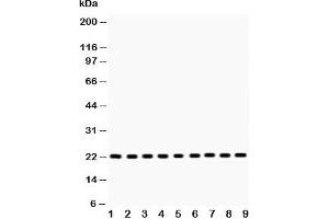 Image no. 1 for anti-Suppressor of Cytokine Signaling 2 (SOCS2) (C-Term) antibody (ABIN3029043)