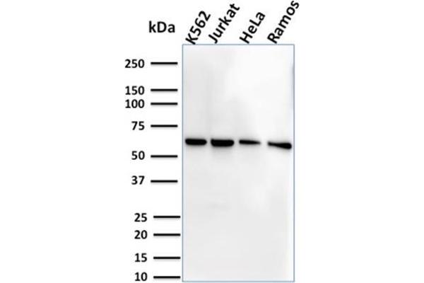 anti-Interleukin 7 Receptor (IL7R) (AA 21-236) antibody