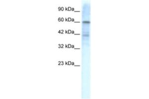 Image no. 1 for anti-Potassium Voltage-Gated Channel, Shal-Related Subfamily, Member 3 (KCND3) antibody (ABIN2461109)