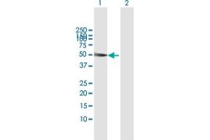 Image no. 2 for anti-SH2 Domain Protein 2A (SH2D2A) (AA 1-389) antibody (ABIN522483)
