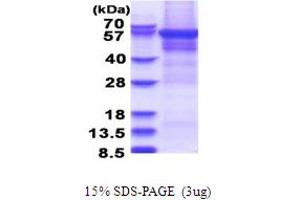 Image no. 1 for Cytoplasmic Polyadenylation Element Binding Protein 1 (CPEB1) (AA 1-561) protein (His tag) (ABIN5853676)