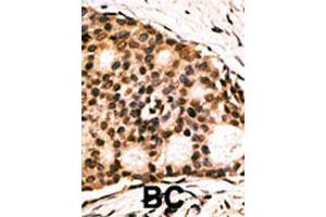 Image no. 2 for anti-Caudal Type Homeobox 1 (CDX1) (AA 236-265), (C-Term) antibody (ABIN390075)