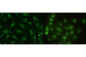 Image no. 1 for anti-S100 Calcium Binding Protein A13 (S100A13) (AA 1-98) antibody (ABIN1997905)