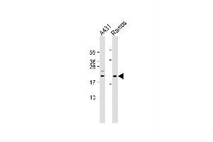 Image no. 4 for anti-BCL2-Interacting Killer (Apoptosis-Inducing) (BIK) (AA 39-74) antibody (ABIN388114)