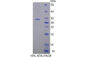 Image no. 1 for BMX Non-Receptor Tyrosine Kinase (BMX) (AA 209-446) protein (His tag) (ABIN6238217)