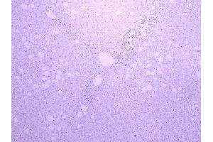 Image no. 1 for anti-Cytochrome P450, Family 3, Subfamily A, Polypeptide 4 (CYP3A4) (Internal Region) antibody (ABIN185606)