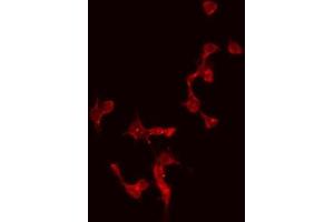 Image no. 1 for anti-Cerebellin 4 Precursor (CBLN4) (Internal Region) antibody (ABIN6258545)