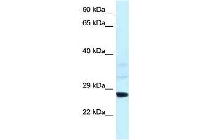 Image no. 1 for anti-Vacuolar-sorting Protein SNF8 (SNF8) (N-Term) antibody (ABIN2777633)