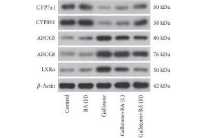 Image no. 4 for anti-ATP-Binding Cassette, Sub-Family G (WHITE), Member 8 (ABCG8) antibody (ABIN3022643)