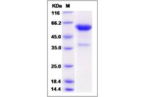 Image no. 1 for Collagen, Type IV, alpha 3 (COL4A3) (AA 1426-1670) protein (Fc Tag) (ABIN2009622)