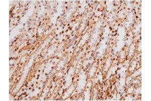 Image no. 5 for anti-Mast/stem Cell Growth Factor Receptor (KIT) (pTyr721) antibody (ABIN6256004)