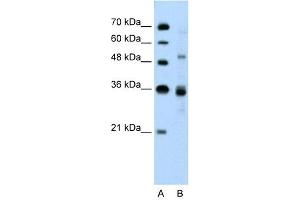 CELF3 Antikörper  (N-Term)
