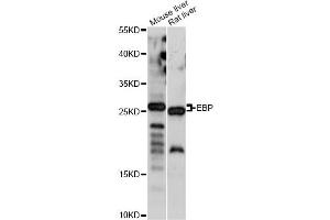 Image no. 1 for anti-Emopamil Binding Protein (Sterol Isomerase) (EBP) antibody (ABIN6568497)