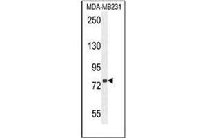 Image no. 3 for anti-Sorbin and SH3 Domain Containing 1 (SORBS1) (AA 869-896), (Middle Region) antibody (ABIN954882)