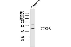 Image no. 5 for anti-Cholecystokinin B Receptor (CCKBR) (AA 301-400) antibody (ABIN734318)