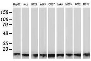 Image no. 1 for anti-ATPase, H+ Transporting, Lysosomal 14kDa, V1 Subunit F (ATP6V1F) antibody (ABIN1496778)