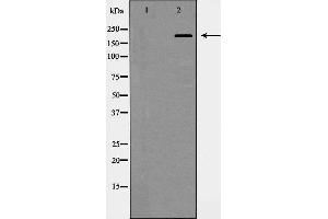 Image no. 1 for anti-Integrin beta 4 (ITGB4) antibody (ABIN6262617)