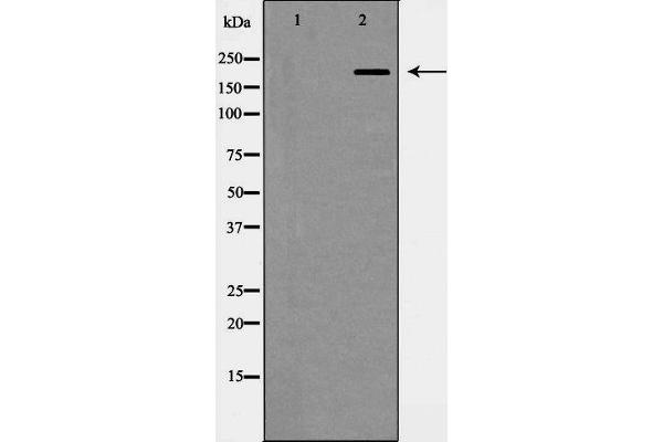 anti-Integrin beta 4 (ITGB4) (C-Term) antibody