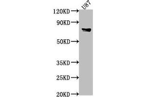 Western Blot Positive WB detected in: U87 whole cell lysate, Mouse heart tissue All lanes: FEM1B antibody at 1:2000 Secondary Goat polyclonal to rabbit IgG at 1/50000 dilution Predicted band size: 71 kDa Observed band size: 71 kDa