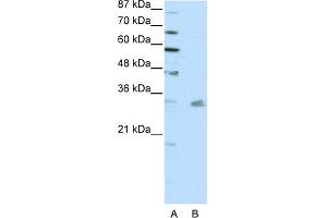 Image no. 1 for anti-Pituitary Homeobox 3 (PITX3) (N-Term) antibody (ABIN2780637)