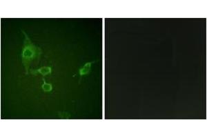 Image no. 2 for anti-Hemopoietic Cell Kinase (HCK) (AA 381-430) antibody (ABIN1532620)