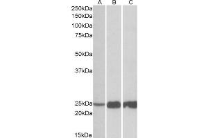 Image no. 1 for anti-Fast Skeletal Troponin I (TNNI2) (N-Term) antibody (ABIN1590039)