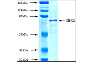 Image no. 1 for Checkpoint Kinase 2 (CHEK2) (Active) protein (ABIN411919)