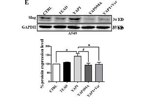 Image no. 11 for anti-Glyceraldehyde-3-Phosphate Dehydrogenase (GAPDH) antibody (ABIN3020541)