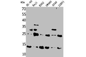 TXNDC17 antibody  (Internal Region)