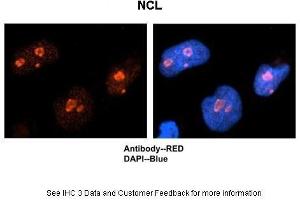 Image no. 4 for anti-Nucleolin (NCL) (C-Term) antibody (ABIN2778936)