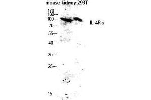 Image no. 2 for anti-Interleukin 4 Receptor (IL4R) (Ser540) antibody (ABIN3185177)