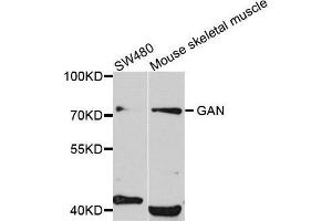 Image no. 1 for anti-Gigaxonin (GAN) antibody (ABIN1679951)