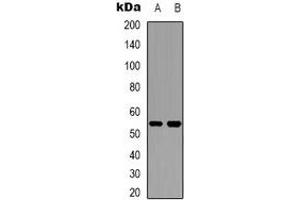 Image no. 1 for anti-Cytochrome P450, Family 2, Subfamily W, Polypeptide 1 (CYP2W1) antibody (ABIN2801450)