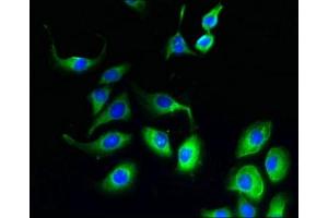 Immunofluorescent analysis of A549 cells using ABIN7152727 at dilution of 1:100 and Alexa Fluor 488-congugated AffiniPure Goat Anti-Rabbit IgG(H+L)
