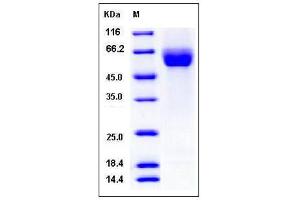 Image no. 1 for Roundabout, Axon Guidance Receptor, Homolog 4 (ROBO4) (AA 1-469) protein (His tag) (ABIN2004922)