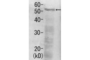 Image no. 1 for anti-Proteasome (Prosome, Macropain) 26S Subunit, Non-ATPase, 12 (PSMD12) antibody (ABIN2452114)