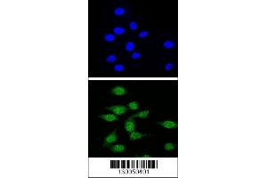 Image no. 2 for anti-Autoimmune Regulator (AIRE) (AA 64-92) antibody (ABIN655031)
