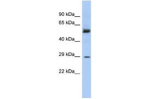 Image no. 1 for anti-Glutathione S-Transferase mu 3 (Brain) (GSTM3) (Middle Region) antibody (ABIN2785445)