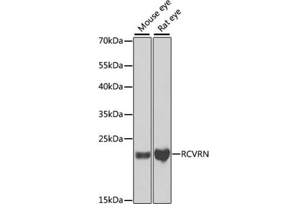 Recoverin antibody  (AA 1-200)